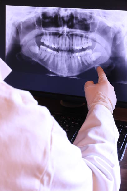 Best Emergency Dental Care for Broken or Chipped Teeth in Aptos, CA