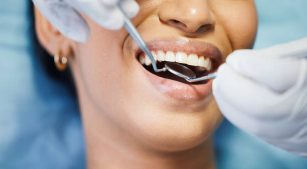 Best Same-Day Emergency Dental Services in Aptos, CA